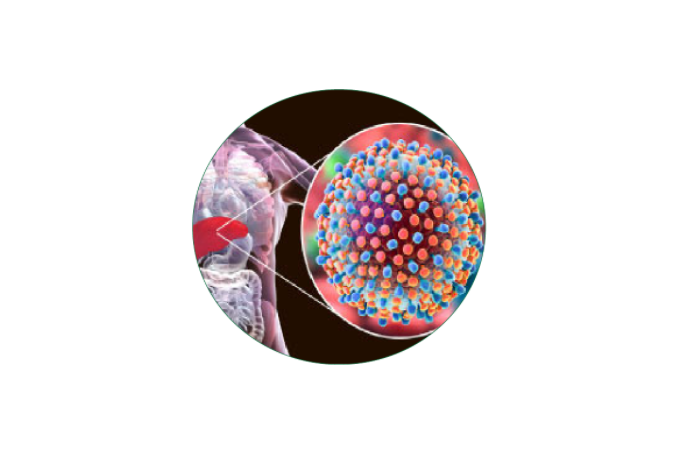 Homeopathy treatment for Hepatitis C in Dubai