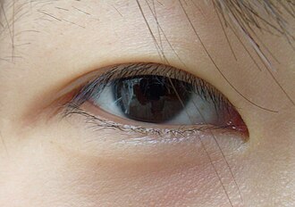 Epicanthic_KR02